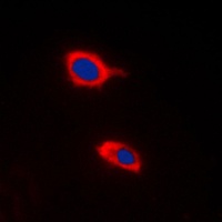 Anti-HCCS Antibody