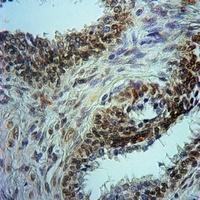 Anti-Histone Deacetylase 1 (Phospho-S421) Antibody