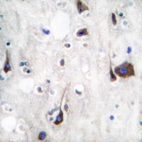 Anti-Neuregulin SMDF Antibody