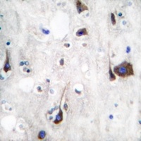 NRG1 antibody