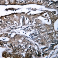 Anti-HLA-G Antibody
