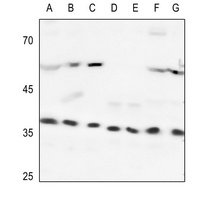 Heme Oxygenase 2 Antibody