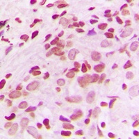 NUR77 Antibody
