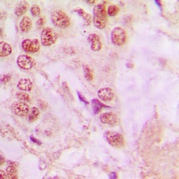 Anti-hnRNP A1 Antibody