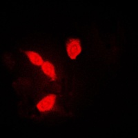 Anti-hnRNP A1 Antibody