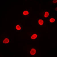 Anti-hnRNP F Antibody