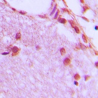 HNRNPH1 antibody