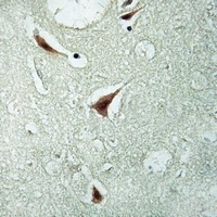 Anti-hnRNP K (Phospho-S284) Antibody