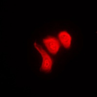 Anti-hnRNP K (Phospho-S284) Antibody