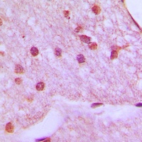 Anti-HOXA1 Antibody