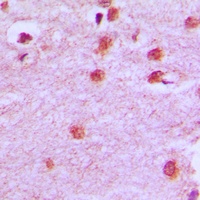 Anti-HOXA11/D11 Antibody