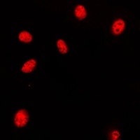 Anti-HOXA11/D11 Antibody