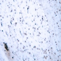 Anti-HOXB2 Antibody