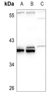 HOXB5 Antibody