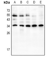 HOXB9 Antibody