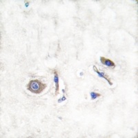 Anti-NRAS/HRAS/KRAS Antibody