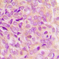 Anti-GRP78 Antibody