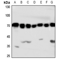 HSC70 Rabbit Polyclonal Antibody