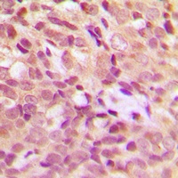 HSPB1 (phospho-S15) antibody