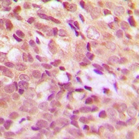 Anti-HSP27 (Phospho-S15) Antibody