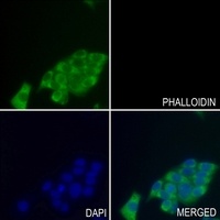 Anti-HSP27 (Phospho-S15) Antibody
