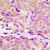 Anti-HSP90 alpha Antibody