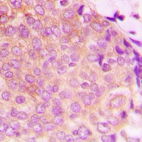 Anti-HSP60 Antibody