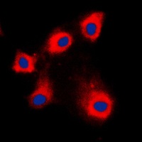 Anti-HSPE1 Antibody