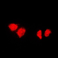 DNAJB1 antibody