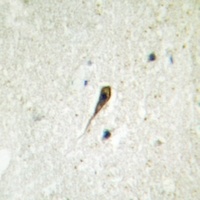 Anti-5-HT1A Antibody