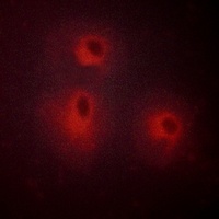 Anti-5-HT1A Antibody