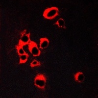 5-HT2B Receptor antibody