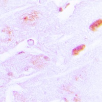 Anti-Amylin Antibody