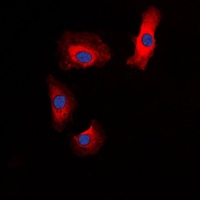 Anti-Amylin Antibody