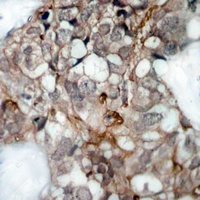 ICAM1 antibody