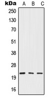 IFN beta Rabbit Polyclonal Antibody