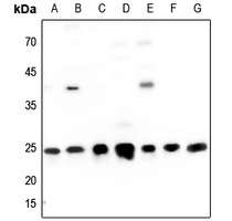IFN gamma Antibody