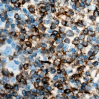IFN gamma Antibody