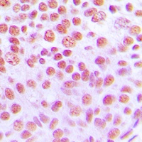 Anti-Cytokine IK Antibody