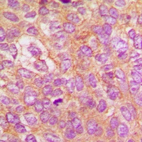 IKK beta (Phospho-Y188) Antibody