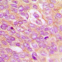 IKK beta (Phospho-Y199) Antibody