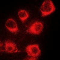 Anti-MYL9 (Phospho-S20) Antibody