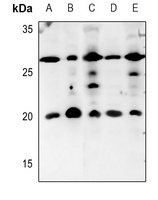 IL-5 Antibody