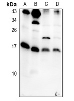 IL-5 Antibody