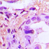 Anti-IL-8 Antibody