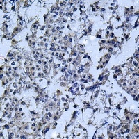 Anti-IL-12B Antibody