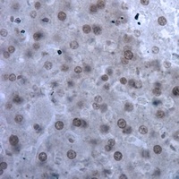 Anti-ILF3 Antibody