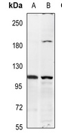 Insulin Receptor Rabbit Polyclonal Antibody