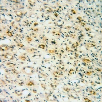 IRAK1 (Phospho-T209) Antibody
