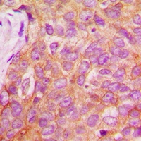 IRS1 (Phospho-S1101) Antibody